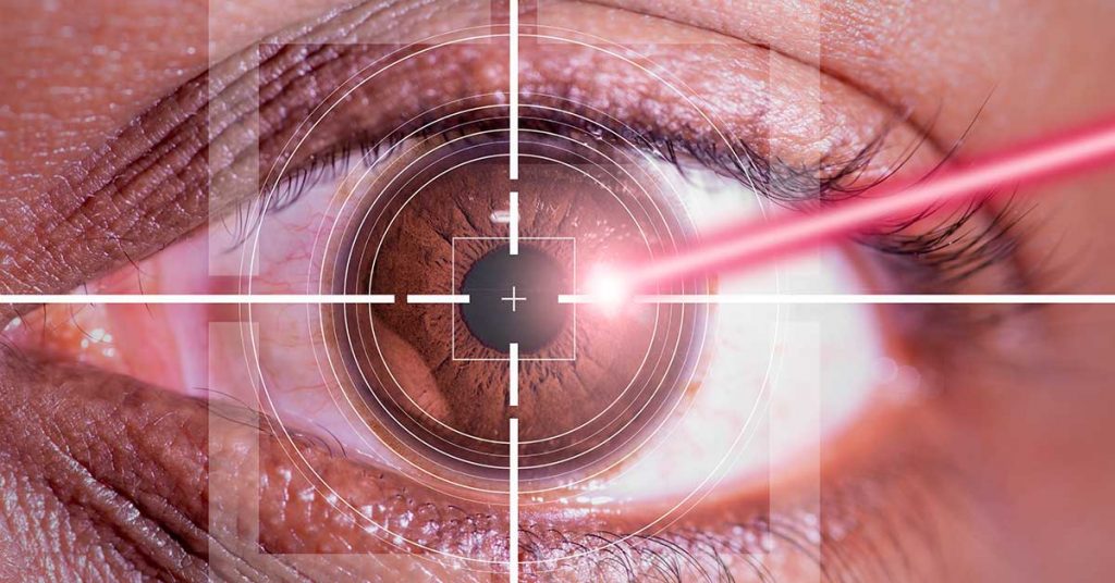 Laser eye surgery (excimer laser) in Kayseri