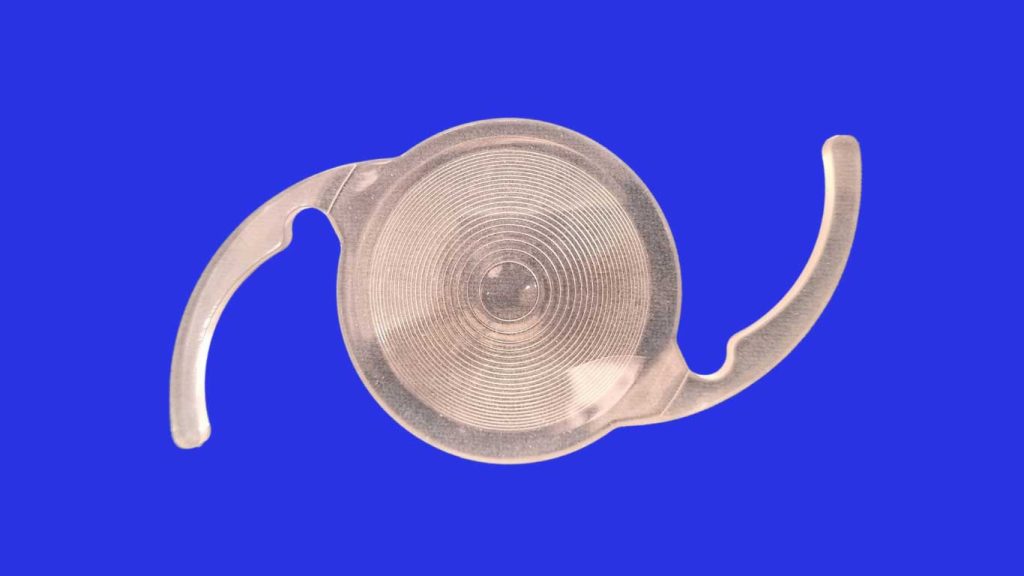 Trifocal (smart) intraocular lens